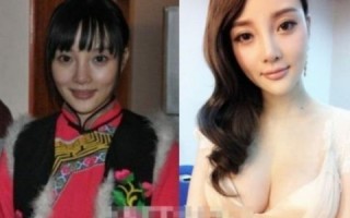 整容最坏的4位明星，整容最坏的4位明星是谁